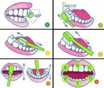 口腔健康第一步，定期洗牙保证牙齿清洁